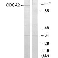 Anti-CDCA2