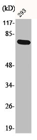 Anti-Phospho-LIMK1 (T508)