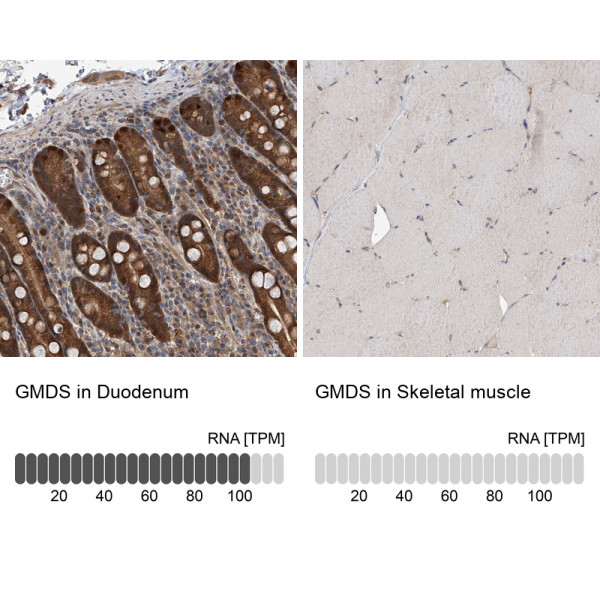 Anti-GMDS