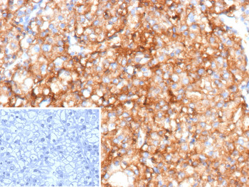 Anti-CD70 / CD70 molecule, clone CD70/12768R
