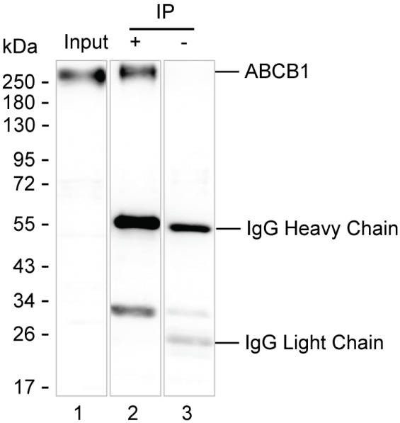 Anti-ABCB1
