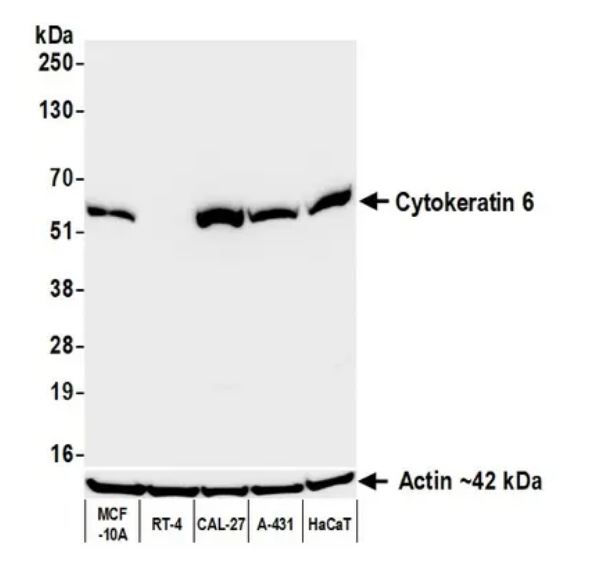 Anti-Cytokeratin 6 Recombinant Monoclonal