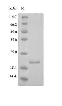 Collagen alpha-1 (XVIII) chain (COL18A1), partial, human, recombinant