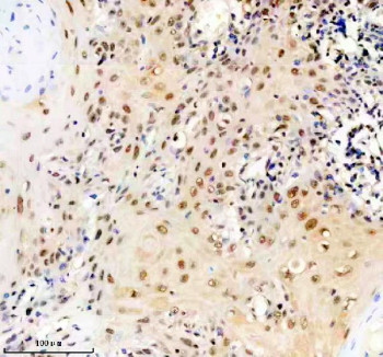 Anti-ERCC2 / DNA excision repair protein ERCC-2 / XPD, clone 2.5E+63