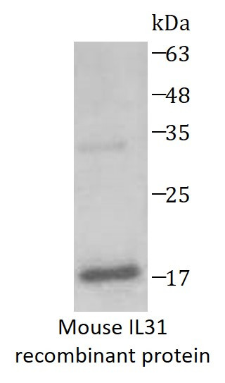 Mouse IL31 recombinant protein (His-tagged)
