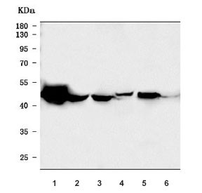Anti-HYAL1