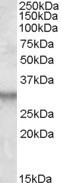 Anti-ITM2B, Internal
