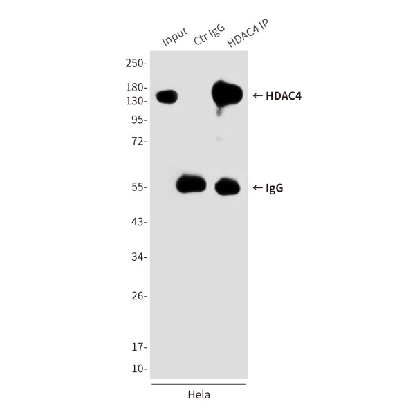 Anti-HDAC4