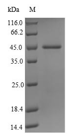 Probable JmjC domain-containing histone demethylation protein 2C (JMJD1C), partial, human, recombina