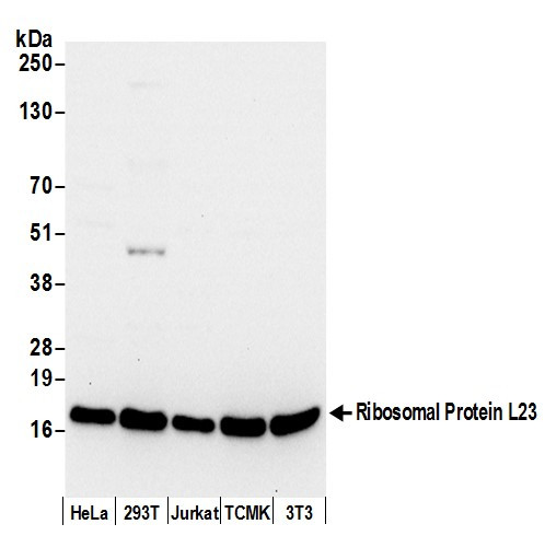 Anti-Ribosomal Protein L23/RPL23
