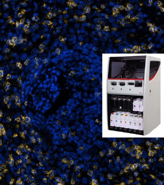 NaveniFlex(TM) BOND RX RED