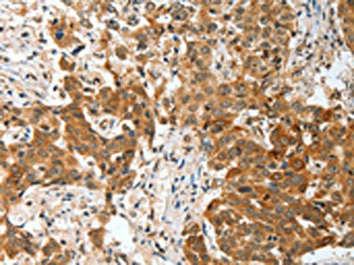 Anti-BNIP1