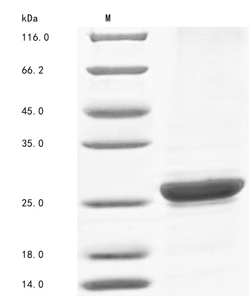 Complement component C8 gamma chain (C8G), human, recombinant