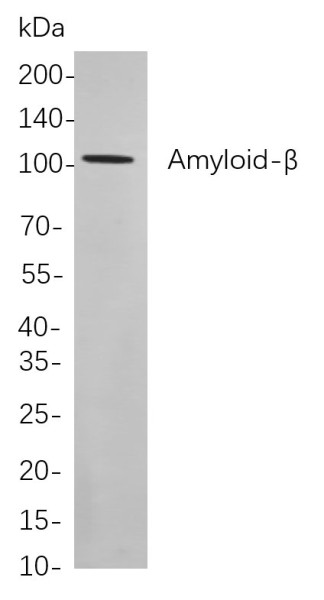 Anti-Recombinant Amyloid-beta, clone 5C9