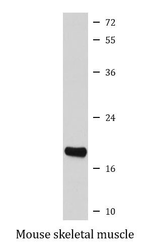 Anti-Hsp 20