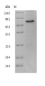 Retinal dehydrogenase 2 (ALDH1A2), human, recombinant