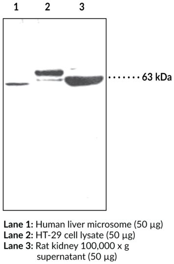 Anti-PCSK9 (human)