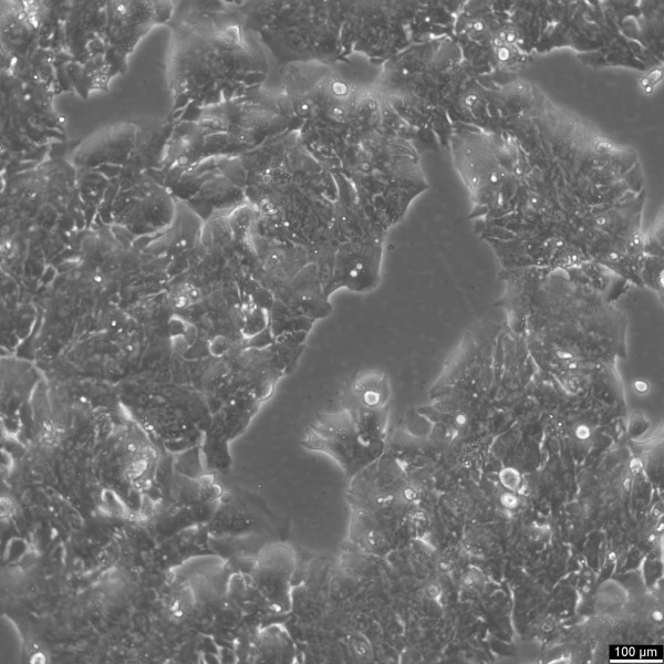HROC334 Cells