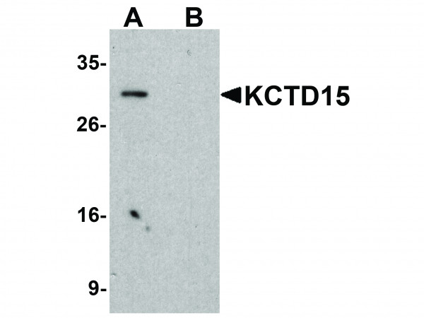 Anti-KCTD15