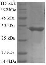 50S ribosomal protein L34 (rpmH), Escherichia coli, recombinant
