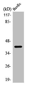Anti-PRDM12