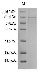 Thioredoxin-interacting protein (TXNIP), human, recombinant