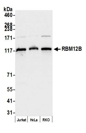Anti-RBM12B