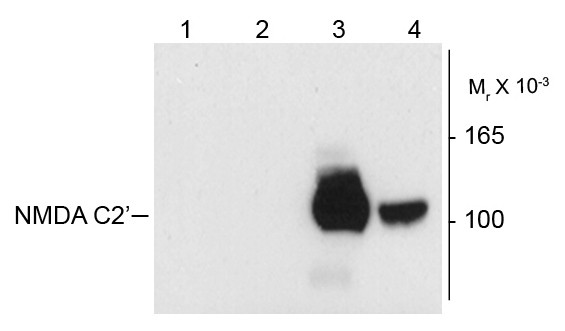 Anti-NMDAR1, Splice Variant C2&#039;