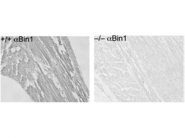 Anti-BIN1, clone 2F11