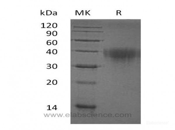 PDCD1/PD-1/CD279 Protein(C-6His) (recombinant human)