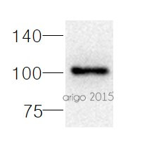Anti-CD34 (Endothelial Cell Marker), clone QBEnd/10