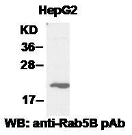 Anti-Rab5B