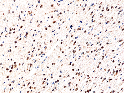 Anti-IDH1 (R132H) (human), Rabbit Monoclonal (RM390)