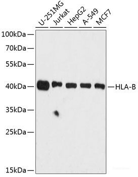 Anti-HLA-B