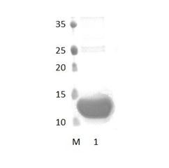 InaDl_2 PDZ Domain