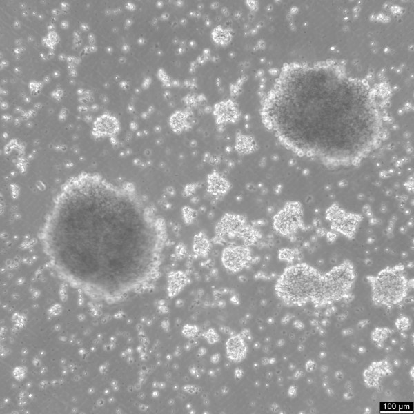 B-LCL-HROC72 Cells