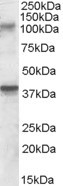 Anti-GRIK3 / GLUR7, Internal