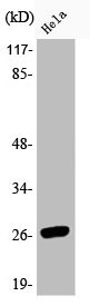 Anti-Phospho-HSPB1 (S78)