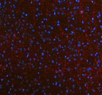 Anti-NEFM / NF-M / Neurofilament medium