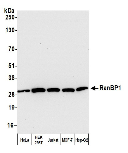 Anti-RanBP1