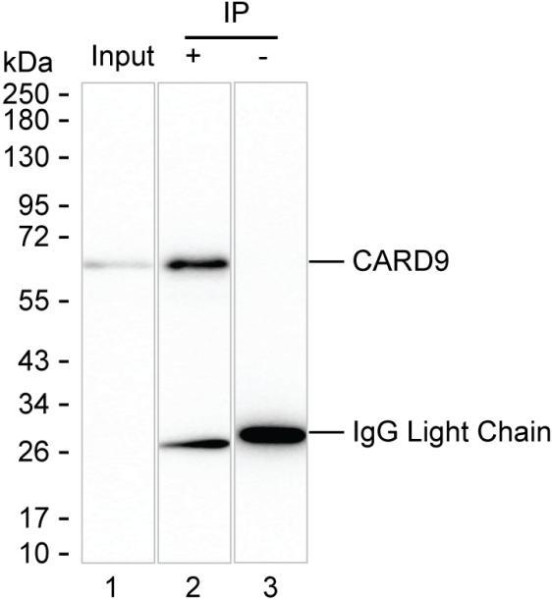 Anti-CARD9