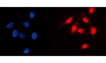 Anti-GCKR / Glucokinase Regulator