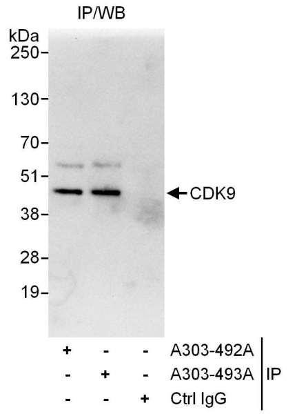 Anti-CDK9