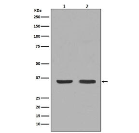 Anti-NGF / Beta Nerve Growth Factor, clone BDE-14