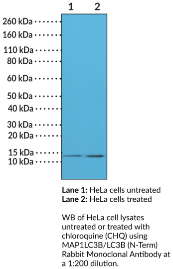 Anti-MAP1LC3B/LC3B (N-Term) Rabbit Monoclonal Antibody (Clone RM293)