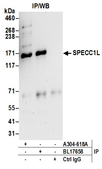 Anti-SPECC1L