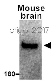 Anti-Nav1.8 Na+ Channel, clone S134-12