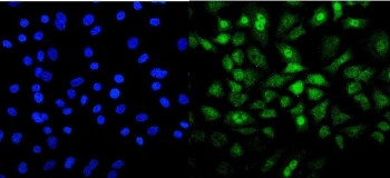 Anti-Mesp2