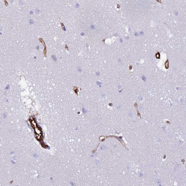 Anti-NXPH1