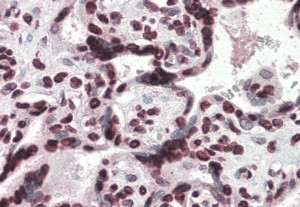 Anti-HMGA1, Internal